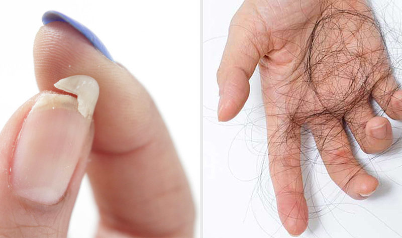  Как предотвратить выпадение волос и ломкость ногтей. Отличный рецепт