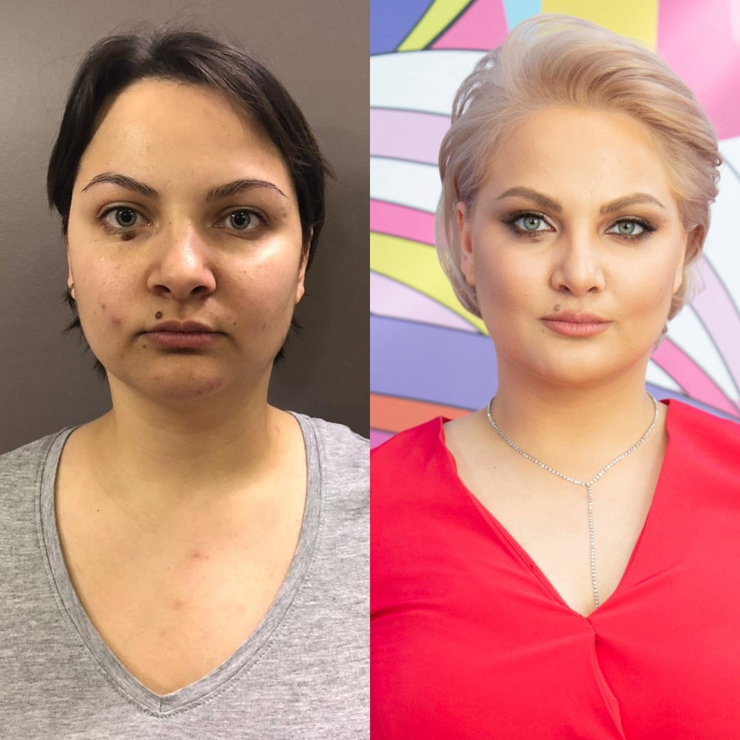 Преображение лица до и после