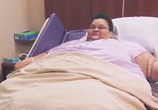  Как 340-килограммовой женщине удалось вернуть свою жизнь