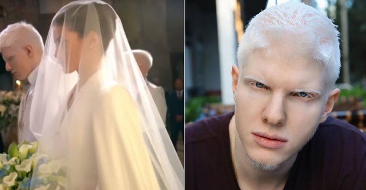  Известный грузинский модель-альбинос женился
