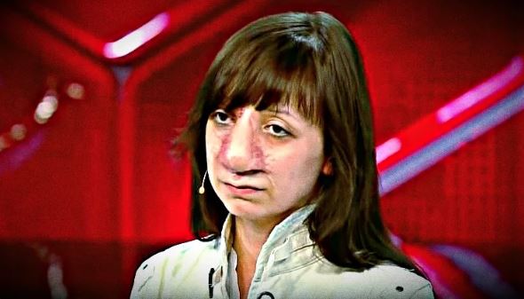  «Её не узнать»: что стало с Яной Муратовой после лечения спустя 4 года