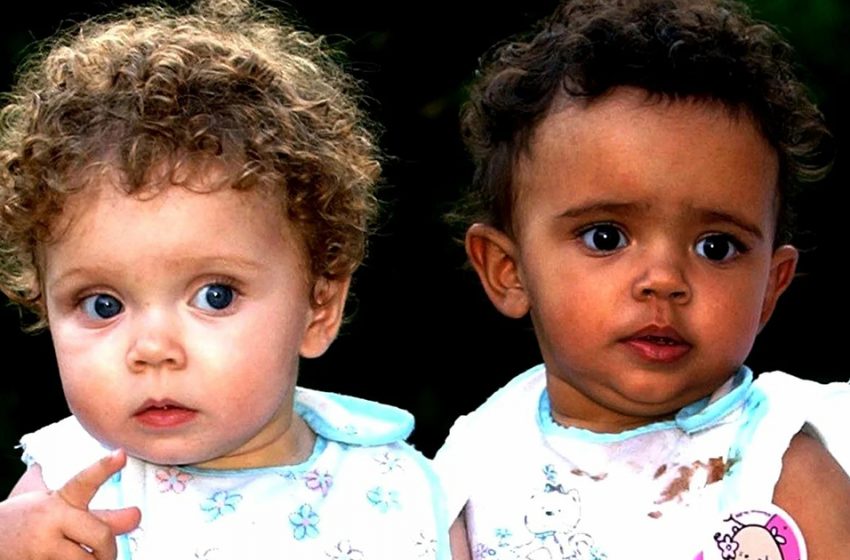  «Разноцветным» близняшкам уже по 13 лет. О жизни знаменитой семьи Биггс