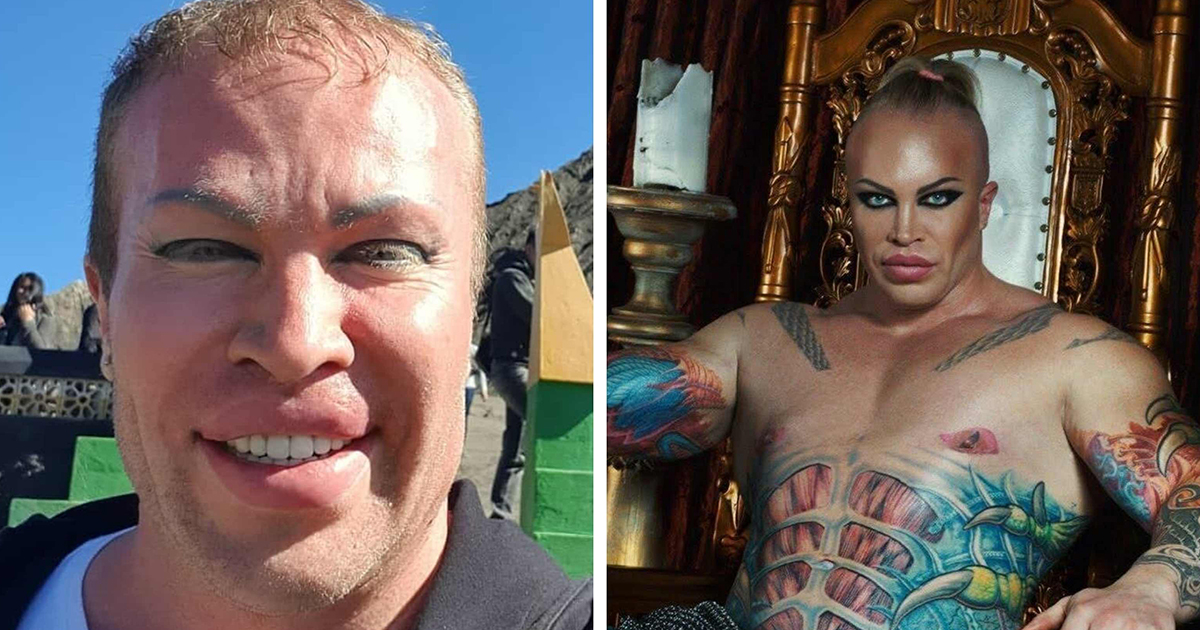 Александр шпак до и после операции фото