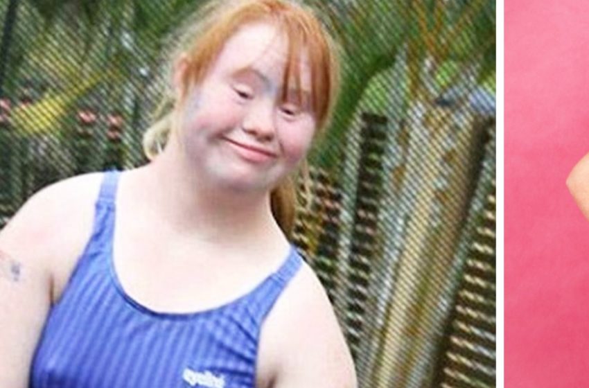  «Болезнь – не приговор!»: Девушка с синдромом Дауна стала всемирно известной моделью, скинув больше 20 кг