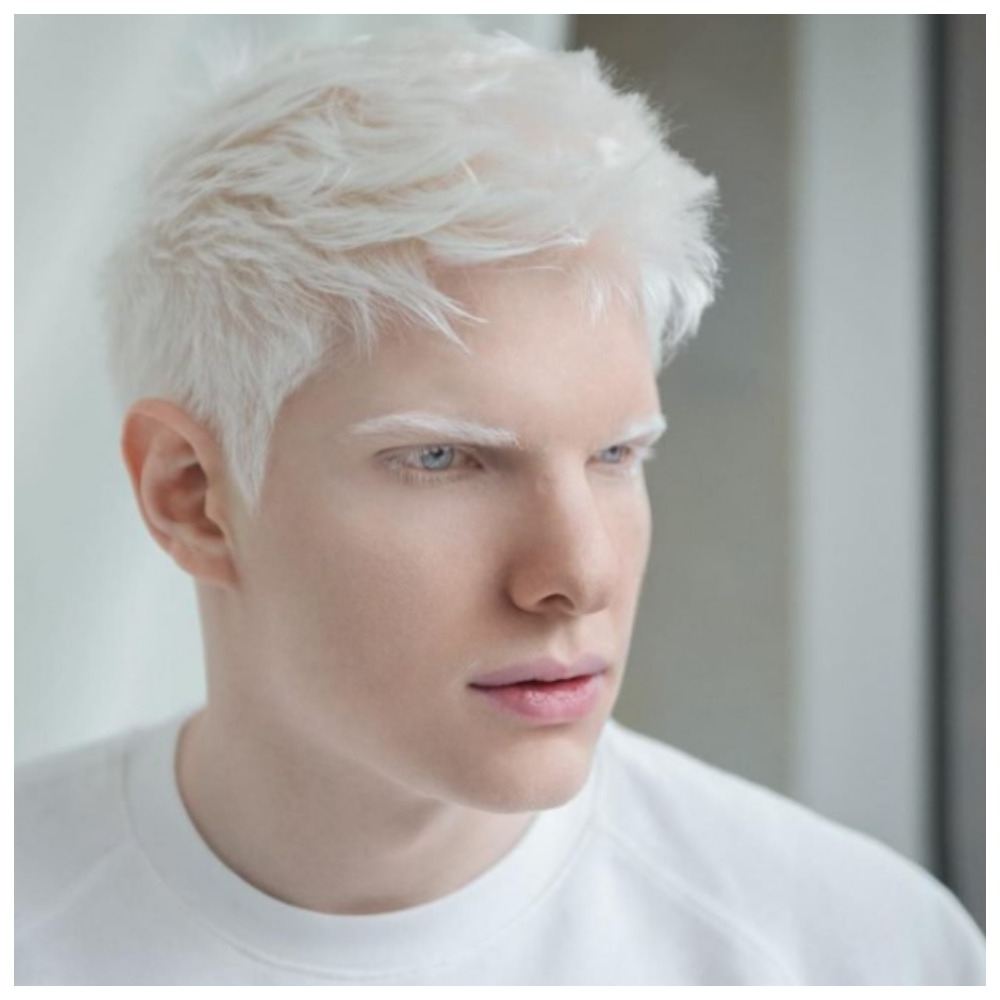 «Тоже белый?»: Как выглядит сын самого популярного певчего альбиноса Земли