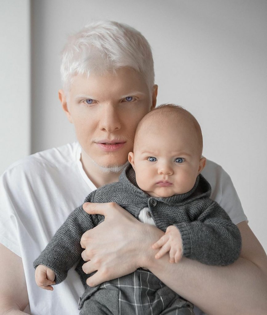 «Тоже белый?»: Как выглядит сын самого популярного певчего альбиноса Земли