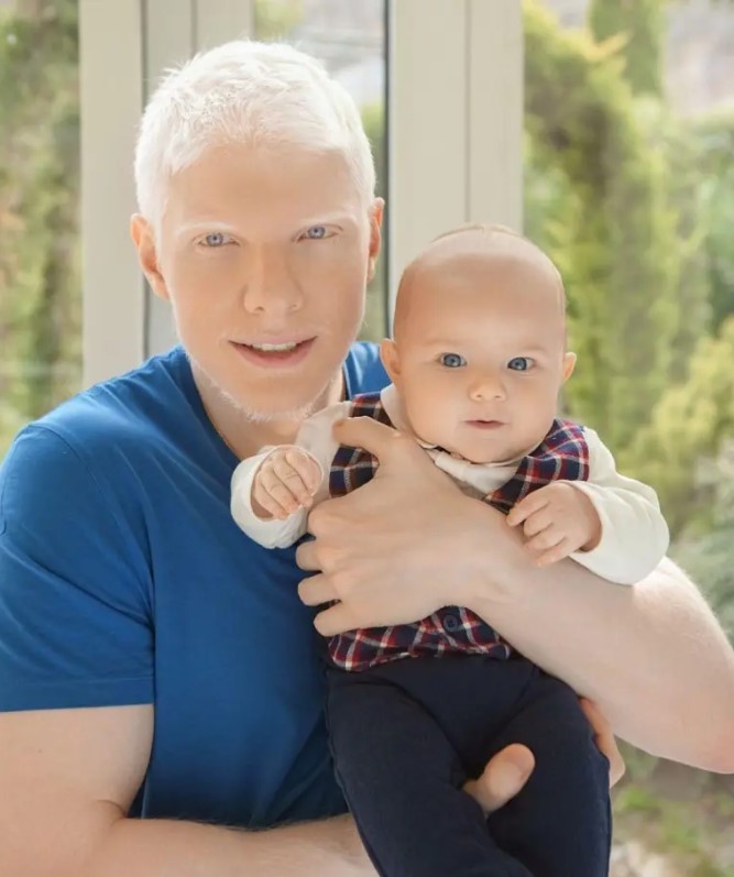 «Очень необычный союз»: как выглядит подросший сын грузинки и её супруга-альбиноса?